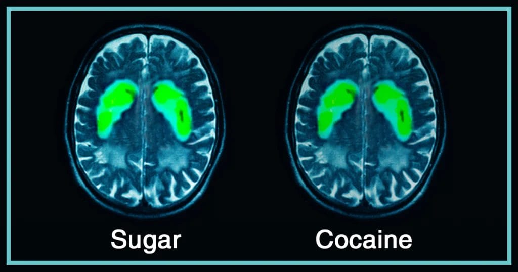 Suiker cocaïne vergelijking werking in het brein